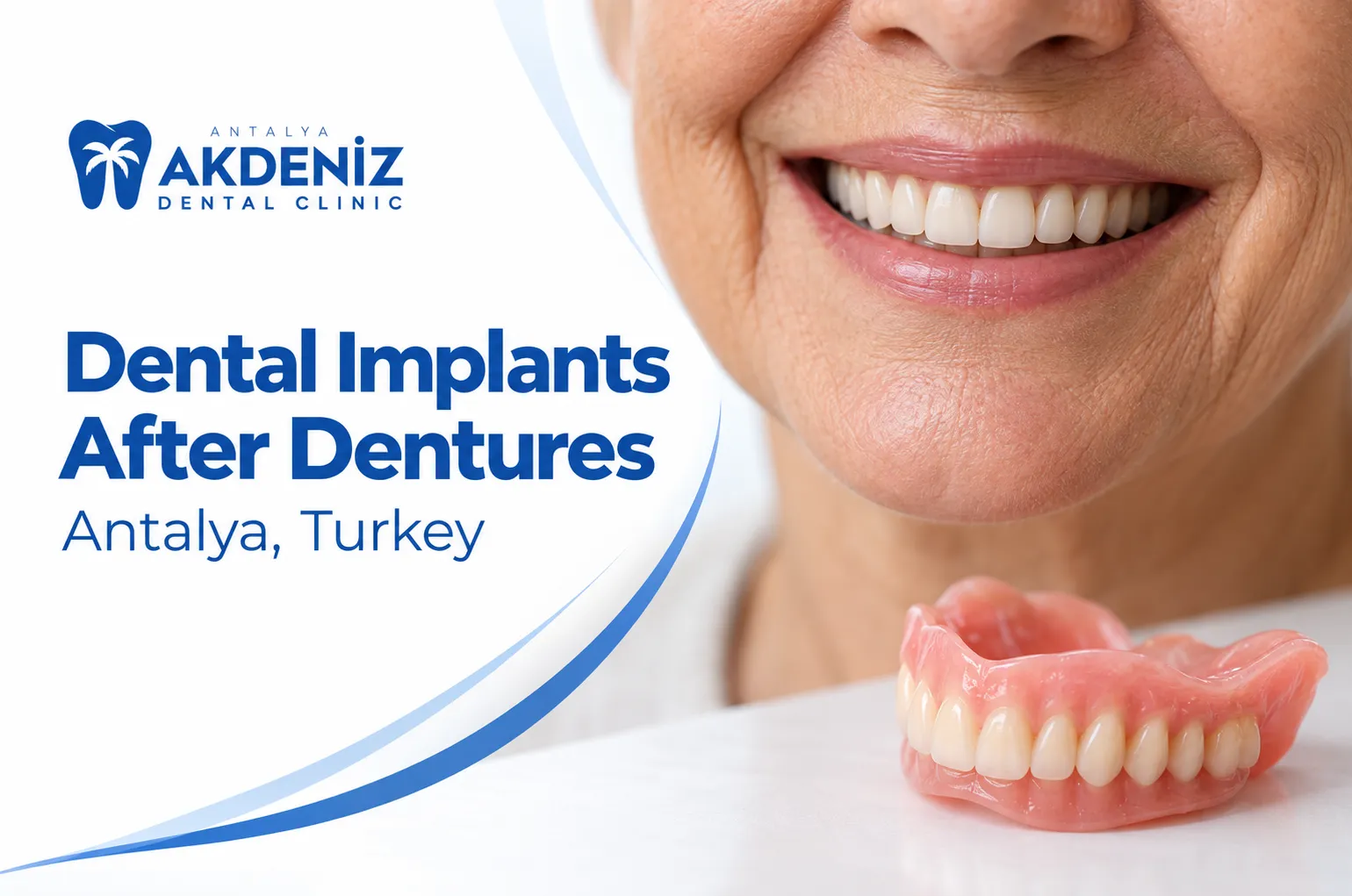 Dental implants after wearing dentures in Antalya, Turkey