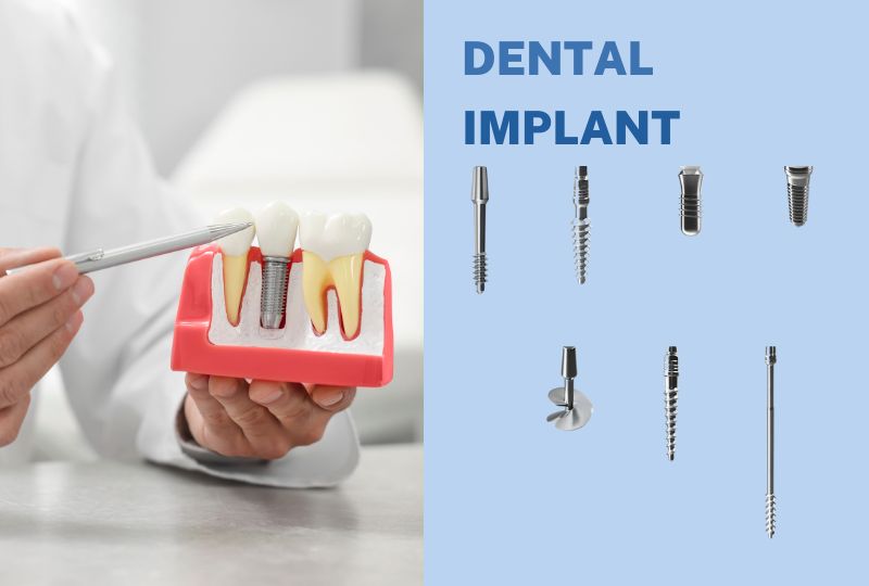 Dental Implant Body