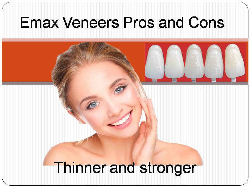 Emax Veneers Pros and Cons