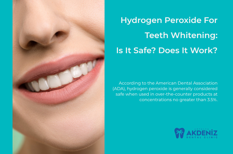 Hydrogen Peroxide for Teeth Whitening