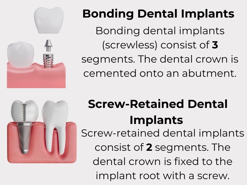 What is screwless dental implants?