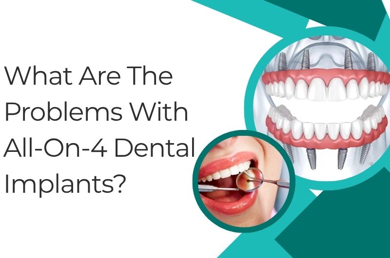 What are the problems with all-on-4 dental implants?