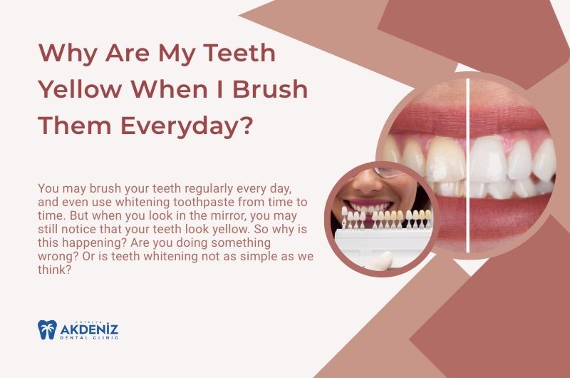 Why Are My Teeth Yellow When I Brush Them Everyday? Why Are My Teeth Yellow When I Brush Them Everyday?